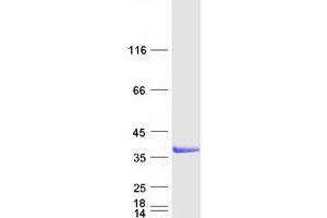 Western Blotting (WB) image for Lectin, Galactoside-Binding, Soluble, 9 (LGALS9) (Transcript Variant 2) protein (Myc-DYKDDDDK Tag) (ABIN2721657)