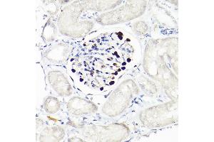 Immunohistochemistry (IHC) image for anti-Wilms Tumor 1 (WT1) antibody (ABIN7271368)
