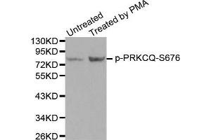 Western blot analysis of extracts from PC12 cells using Phospho-PRKCQ-S676 antibody. (PKC theta Antikörper  (pSer676))
