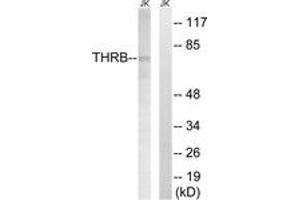 Western blot analysis of extracts from Jurkat cells, treated with etoposide 25uM 24H, using THRB (AP2,Cleaved-Arg327) Antibody.