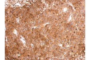 IHC-P Image Tau antibody detects MAPT protein at cytosol on D54MG xenograft by immunohistochemical analysis. (MAPT Antikörper)
