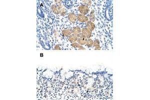 Immunohistochemical staining (Formalin-fixed paraffin-embedded sections) of human kidney (A) and human stomach (B) with DAZ4 polyclonal antibody  at 4-8 ug/mL working concentration. (DAZ4 Antikörper  (N-Term))