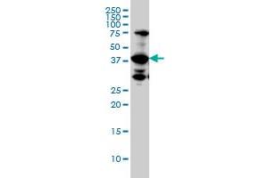 UROD monoclonal antibody (M01A), clone 1G4.