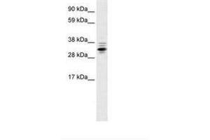 Image no. 2 for anti-Zinc Finger Protein 654 (ZNF654) (AA 289-338) antibody (ABIN6735934) (ZNF654 Antikörper  (AA 289-338))