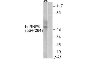 Western blot analysis of extracts from 3T3 cells, treated with EGF (200ng/ml, 30mins), using hnRNP K (Phospho-Ser284) antibody. (HNRNPK Antikörper  (pSer284))