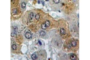 Used in DAB staining on fromalin fixed paraffin-embedded Liver tissue (C4BPB Antikörper  (AA 18-252))