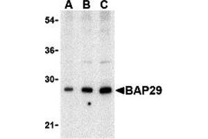 Western Blotting (WB) image for anti-B-Cell Receptor-Associated Protein 29 (BCAP29) (Middle Region) antibody (ABIN1030880) (BCAP29 Antikörper  (Middle Region))