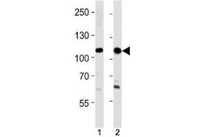 SALL4 antibody western blot analysis in 293,HeLa lysate.