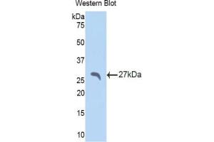 Western blot analysis of the recombinant protein. (APCS Antikörper  (AA 22-222))