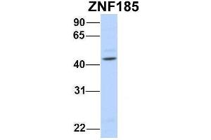 Host:  Rabbit  Target Name:  ZNF185  Sample Type:  Human Fetal Brain  Antibody Dilution:  1.
