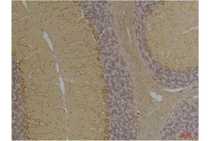 Immunohistochemistry (IHC) analysis of paraffin-embedded Rat Brain Tissue using Kv1.