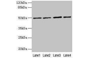 Western blot All lanes: EVA1C antibody at 5 μg/mL Lane 1: Hela whole cell lysate Lane 2: Jurkat whole cell lysate Lane 3: 293T whole cell lysate Lane 4: HL60 whole cell lysate Secondary Goat polyclonal to rabbit IgG at 1/10000 dilution Predicted band size: 50, 8 kDa Observed band size: 50 kDa (EVA1C Antikörper  (AA 49-322))