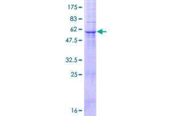 FBXO27 Protein (AA 1-283) (GST tag)