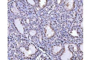 IHC analysis of PC4/SUB1 using anti-PC4/SUB1 antibody (ABIN7602184). (SUB1 Antikörper  (AA 62-127))