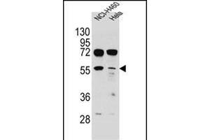 TSPYL6 Antibody (Center) (ABIN655239 and ABIN2844842) western blot analysis in NCI-,Hela cell line lysates (35 μg/lane). (TSPY-Like 6 Antikörper  (AA 206-235))