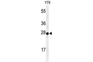 Western blot analysis of AANAT Antibody (N-term) in Y79 cell line lysates (35 µg/lane). (AANAT Antikörper  (N-Term))