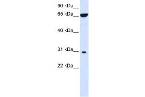 Western Blotting (WB) image for anti-Protein tyrosine Phosphatase-Like A Domain Containing 2 (PTPLAD2) antibody (ABIN2458868) (PTPLAD2 Antikörper)