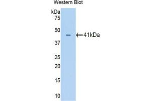 Western blot analysis of the recombinant protein. (Oxytocin Receptor Antikörper  (AA 272-377))