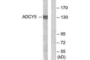 Western blot analysis of extracts from COLO205 cells, using ADCY5/6 Antibody. (ADCY5/6 Antikörper  (AA 931-980))
