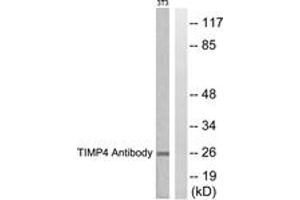 Western blot analysis of extracts from NIH-3T3 cells, using TIMP4 Antibody. (TIMP4 Antikörper  (AA 175-224))