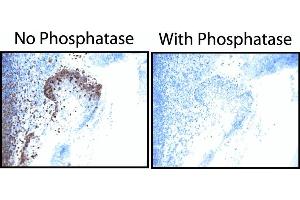 EGF Receptor (pY845) staining on tonsil. (EGFR Antikörper  (pTyr845))