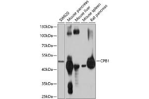 Western blot analysis of extracts of various cell lines, using CPB1 antibody (ABIN6131301, ABIN6138934, ABIN6138935 and ABIN6214759) at 1:1000 dilution. (CPB1 Antikörper  (AA 111-417))