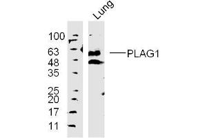 Lane 1: mouse lung lysates probed with 	PLAG1 Polyclonal Antibody, Unconjugated  at 1:300 overnight at 4˚C. (PLAG1 Antikörper  (AA 51-150))