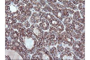 Image no. 2 for anti-Carboxypeptidase A2 (Pancreatic) (CPA2) antibody (ABIN1497596)