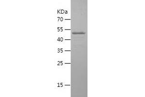 Western Blotting (WB) image for Superoxide Dismutase 3, Extracellular (SOD3) (AA 19-240) protein (His-IF2DI Tag) (ABIN7125250) (SOD3 Protein (AA 19-240) (His-IF2DI Tag))