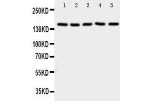 Western Blotting (WB) image for anti-Replication Factor C (Activator 1) 1, 145kDa (RFC1) (AA 46-64), (N-Term) antibody (ABIN3043075) (RFC1 Antikörper  (N-Term))