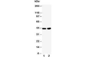 Western blot testing of BCAT1 antibody and Lane 1:  HeLa;  2: Jurkat cell lysate (BCAT1 Antikörper  (C-Term))