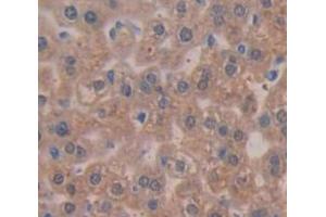IHC-P analysis of Mouse Tissue, with DAB staining. (TPSAB1 Antikörper  (AA 149-273))