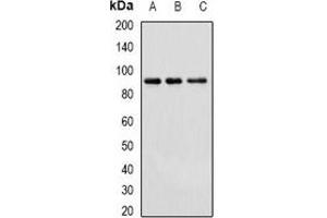 Western blot analysis of Cullin 4A expression in Hela (A), HepG2 (B), mouse brain (C) whole cell lysates. (Cullin 4A Antikörper)