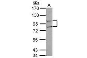 Image no. 1 for anti-CTD (Carboxy-terminal Domain, RNA Polymerase II, Polypeptide A) Phosphatase, Subunit 1 (CTDP1) (N-Term) antibody (ABIN1494011)