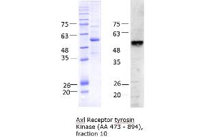 Western Blotting (WB) image for AXL Receptor tyrosine Kinase (AXL) (AA 473-894) protein (His tag) (ABIN3096241)