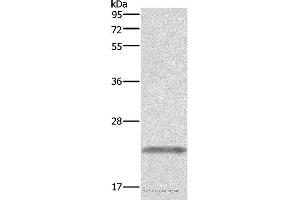 Western blot analysis of Human placenta tissue, using GH1 Polyclonal Antibody at dilution of 1:500 (Growth Hormone 1 Antikörper)