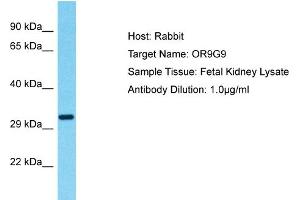 Host: Rabbit Target Name: OR9G9 Sample Type: Fetal Kidney lysates Antibody Dilution: 1. (OR9G9 Antikörper  (C-Term))