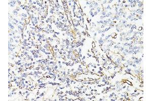 Immunohistochemistry of paraffin-embedded human tonsil using VIM antibody. (Vimentin Antikörper  (AA 1-101))