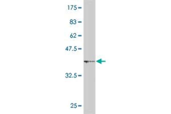 Mahogunin RING Finger Protein 1 Antikörper  (AA 477-576)