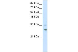 WB Suggested Anti-RNF113B Antibody Titration:  1. (RNF113B Antikörper  (C-Term))