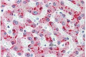 Human Liver (formalin-fixed, paraffin-embedded) stained with CFH antibody ABIN462334 followed by biotinylated anti-mouse IgG secondary antibody ABIN481714, alkaline phosphatase-streptavidin and chromogen. (Complement Factor H Antikörper)