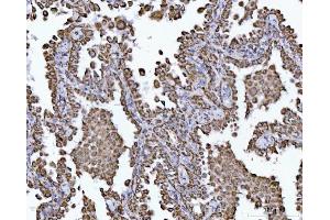 IHC analysis of ECHS1 using anti-ECHS1 antibody (ABIN7599813).