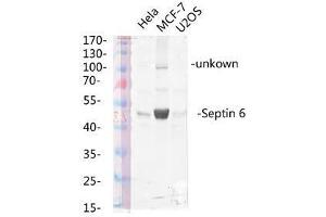 Western Blot (WB) analysis of specific lysis using Septin 6 Polyclonal Antibody. (Septin 6 Antikörper  (Internal Region))