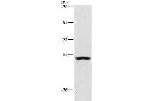 Western Blot analysis of Mouse kidney tissue using SYT17 Polyclonal Antibody at dilution of 1:650 (SYT17 Antikörper)