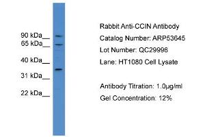WB Suggested Anti-CCIN  Antibody Titration: 0. (Calicin Antikörper  (N-Term))