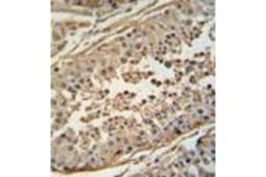 Immunohistochemistry analysis in formalin fixed and paraffin embedded human testis tissue reacted with FBXO24 Antibody  followed by peroxidase conjugation of the secondary antibody and DAB staining.