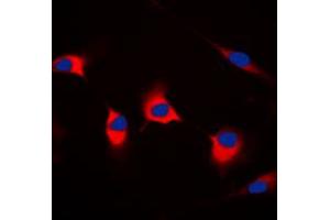 Immunofluorescent analysis of CDKL4 staining in MCF7 cells. (CDKL4 Antikörper  (C-Term))