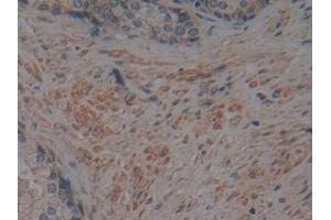 Detection of CRN in Human Prostate Tissue using Polyclonal Antibody to Corin (CRN)