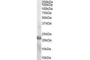 ABIN184689 staining (2µg/ml) of MOLT-4 lysate (RIPA buffer, 35µg total protein per lane). (RAC2 Antikörper  (C-Term))