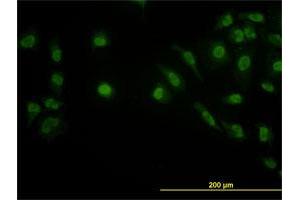 Immunofluorescence (IF) image for anti-LIM Domain Binding 2 (LDB2) (AA 1-373) antibody (ABIN563934)